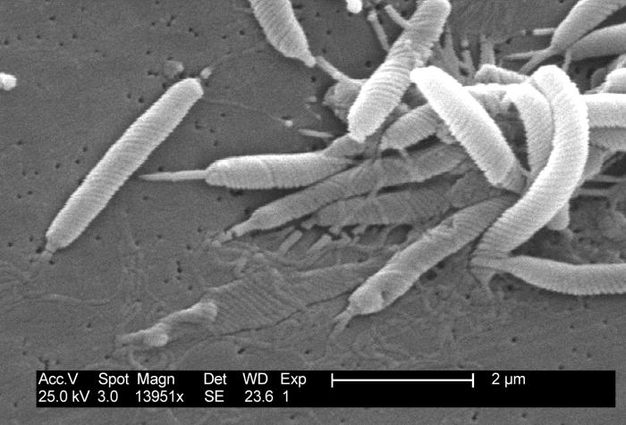 Industrial Monitor - první antimikrobiální dotykový displej společnosti Corning zobrazující detail skupiny bakterií